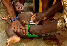 女性割礼图片,视觉冲击下的社会反思